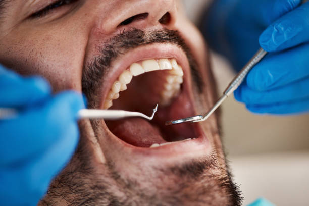 Best Broken or Chipped Tooth Repair in Tazewell, VA